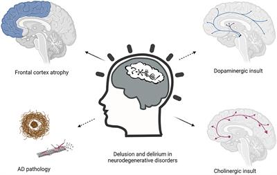 Delusion and Delirium in Neurodegenerative Disorders: An Overlooked Relationship?